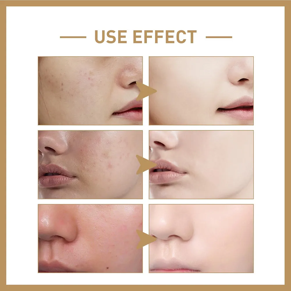 تونر الارز اليابانية والحساسة 120 مل بايو اكوا - الصورة 3